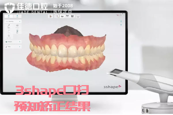 合肥牙齿矫正医院排名前十